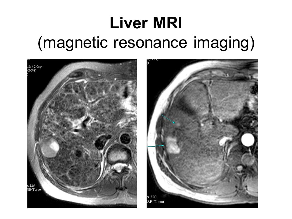Liver imaging